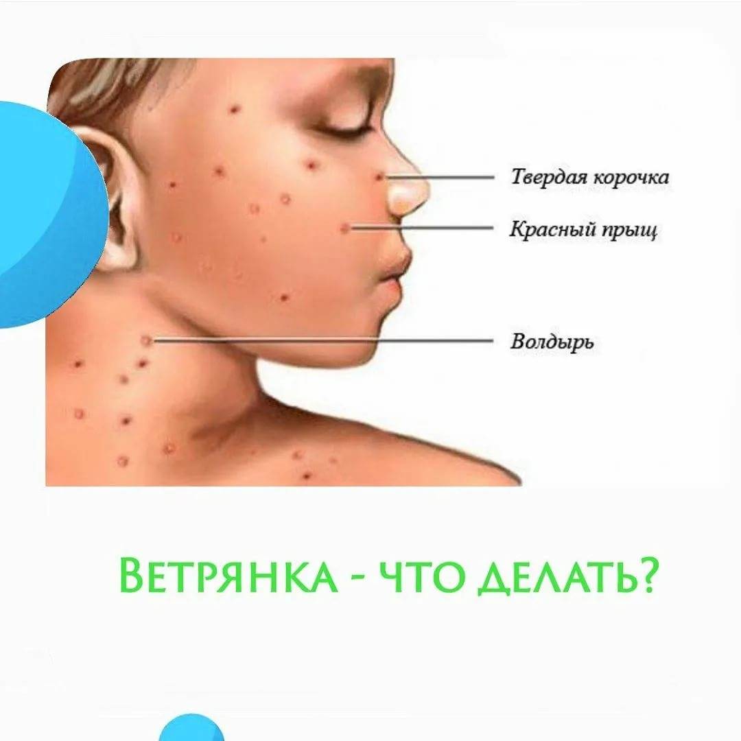 375b259d4525d49a1debeda55c08b1c9.jpeg