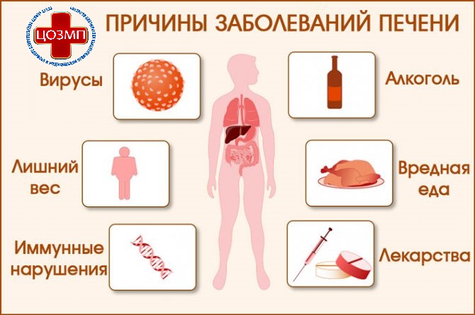 prichiny-zabolevanij-pecheni.jpg