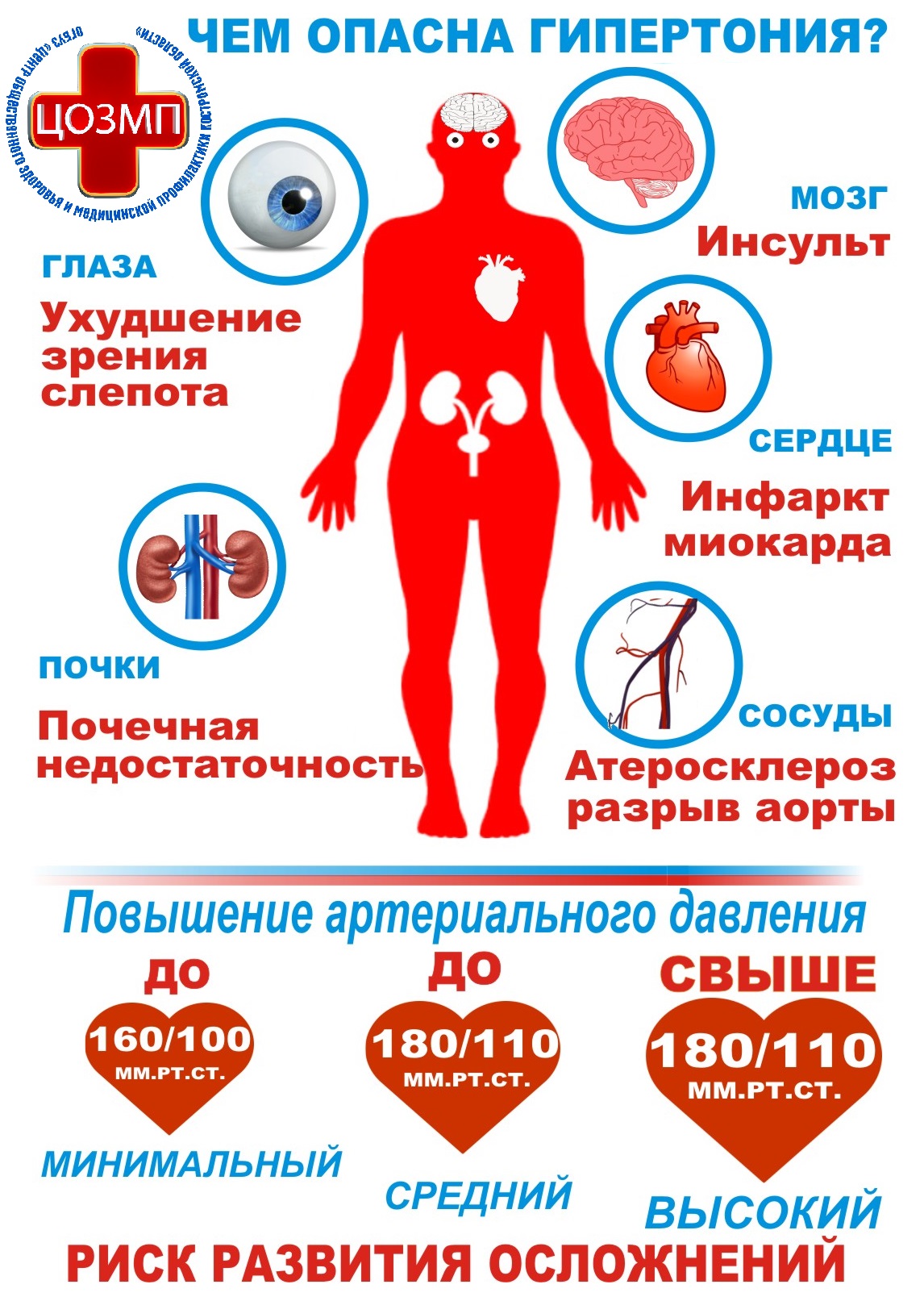Чем опасна гипертония.jpg