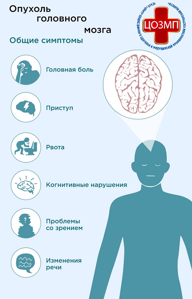опухоль головного мозга.jpg